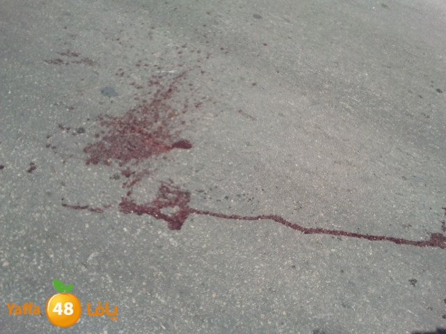 accedentkedem455 (2).jpg